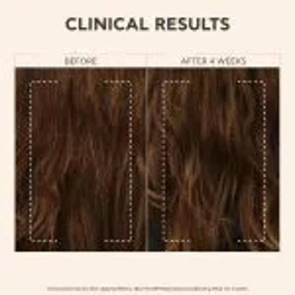 apivita-b-rje-conditioner-before-after.webp
