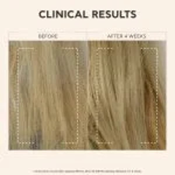 apivita-b-rje-sampoo-before-after.webp