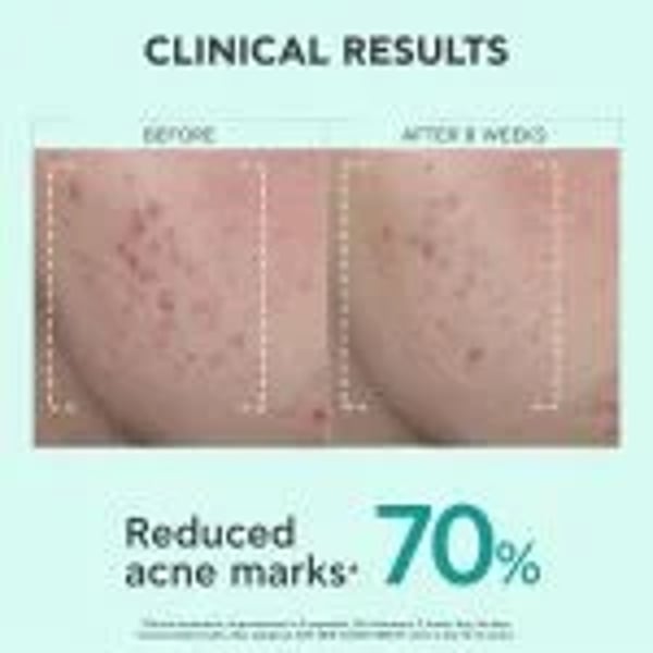 clinical-results.webp
